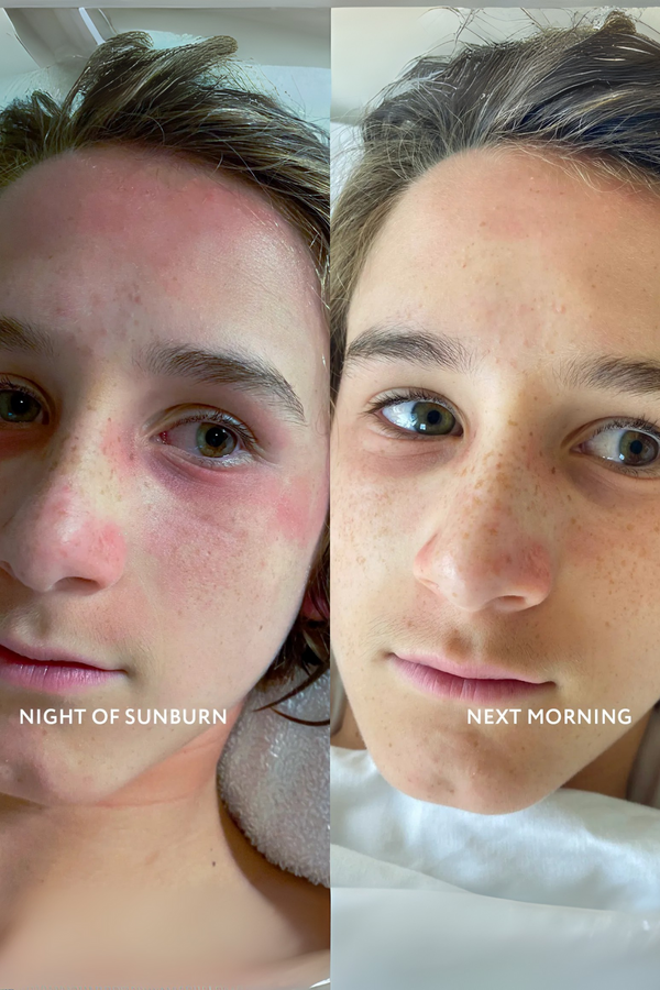 Vanilla Mozi Lavender Sunburn Face and Body Oil